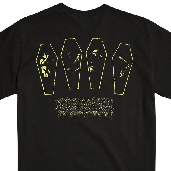 【お取り寄せ】Hyperdontia / ハイパードンティア - NEXUS OF TEETH Tシャツ(ブラック)